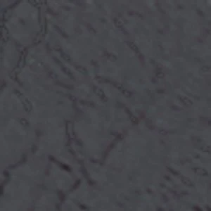Mattea - Image 2